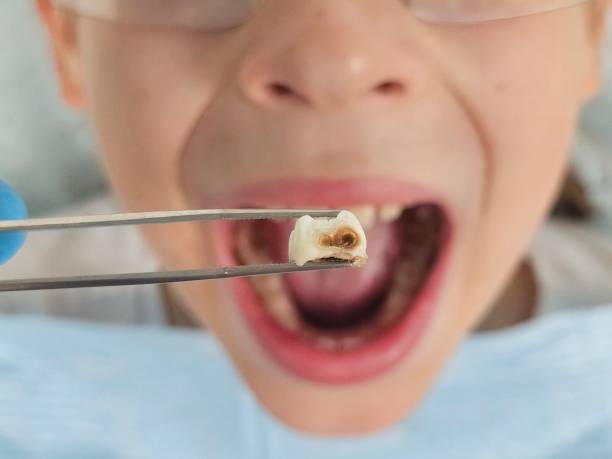 Best Emergency Dental Services for Seniors in Greencastle, PA